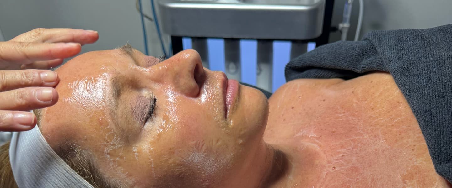 HydraFacial treatment session at Palm Beach Cosmetic Medicine in Wellington, FL