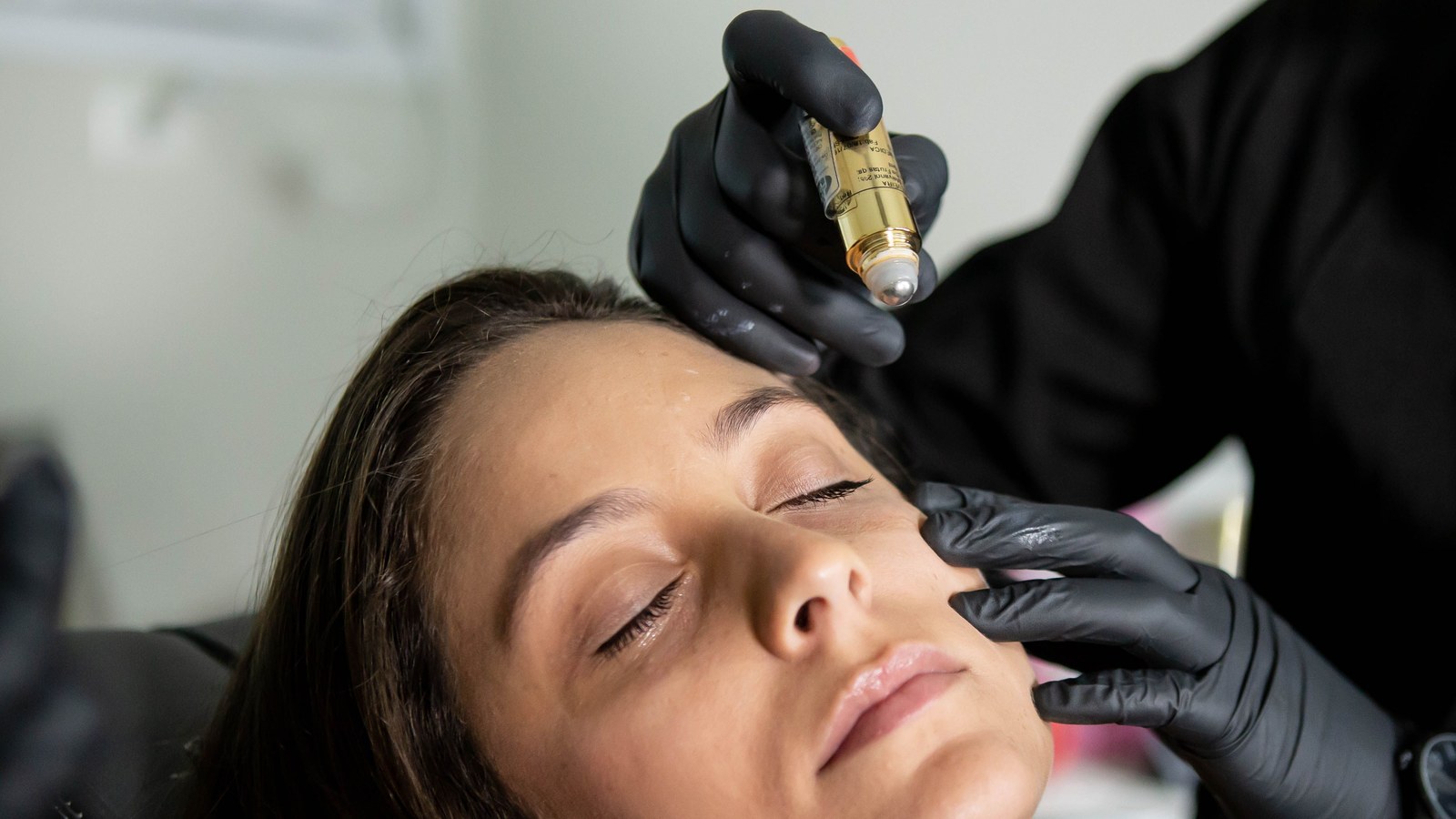 Gloved clinician holding a microneedling roller applicator above a relaxed patient's face during a collagen induction treatment
