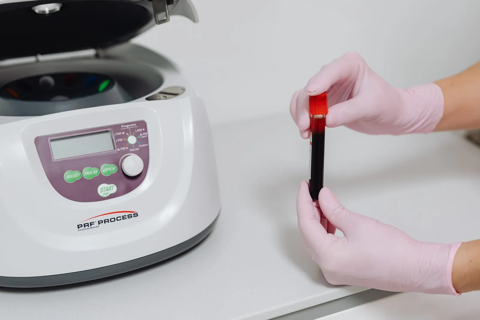 Manos con guantes preparando una muestra de plasma rico en plaquetas junto a una centrífuga en una clínica dirigida por médicos